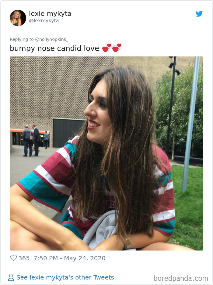 Noses-Look-Like-Before-Photos