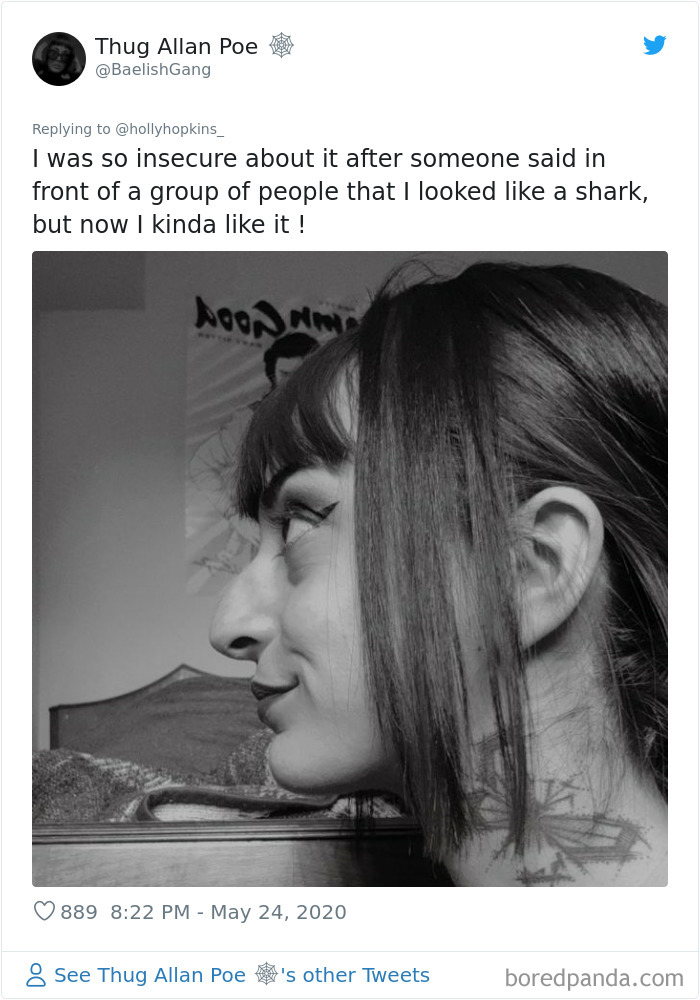 Noses-Look-Like-Before-Photos