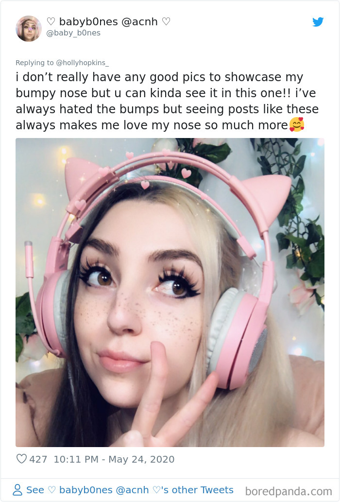 Noses-Look-Like-Before-Photos