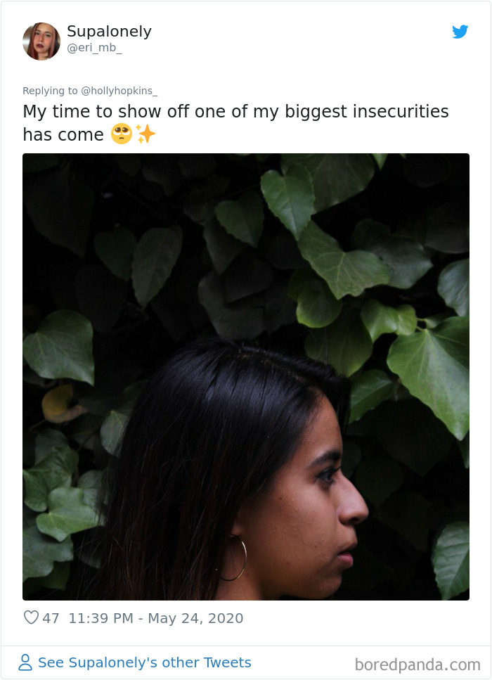 Noses-Look-Like-Before-Photos