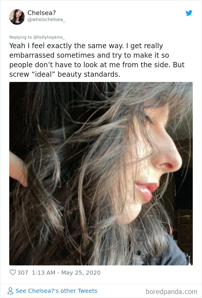 Noses-Look-Like-Before-Photos