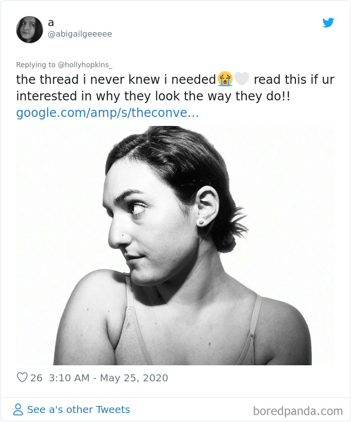 Noses-Look-Like-Before-Photos