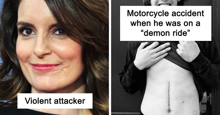 26 Celebrities That Have Visible Scars And The Stories Behind Them