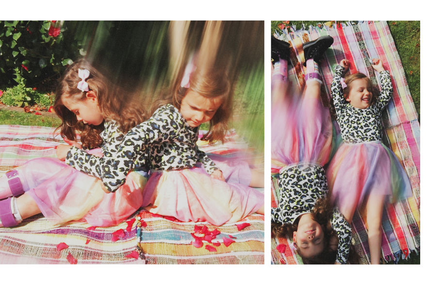 Models With Disabilities And Visbible Differences Take Part In Unique Photoshoots At Home. Project Isolation. Models With Disabilities And Visbible Differences Take Part In Unique Photoshoots At Home. Project Isolation.