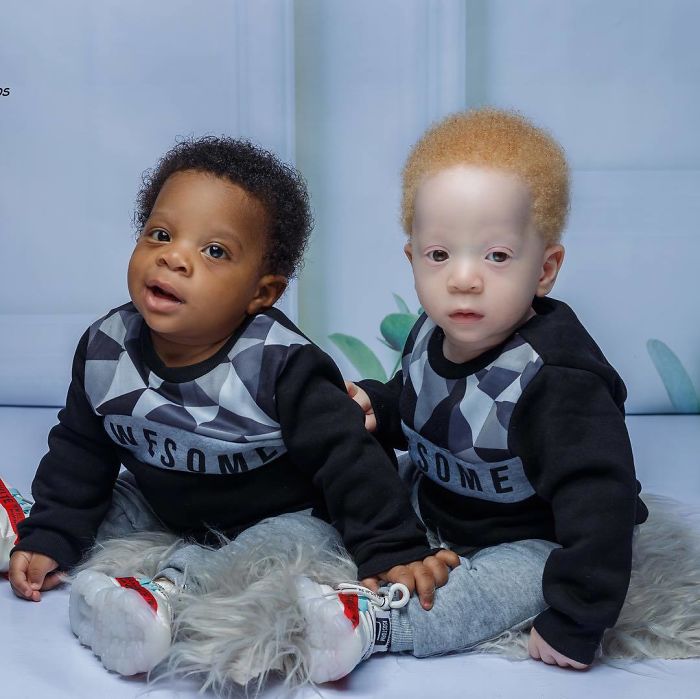 Mom Of Black And White Twins Often Gets Asked Which One Of The Boys Is Hers Mom Of Black And White Twins Often Gets Asked Which One Of The Boys Is Hers
