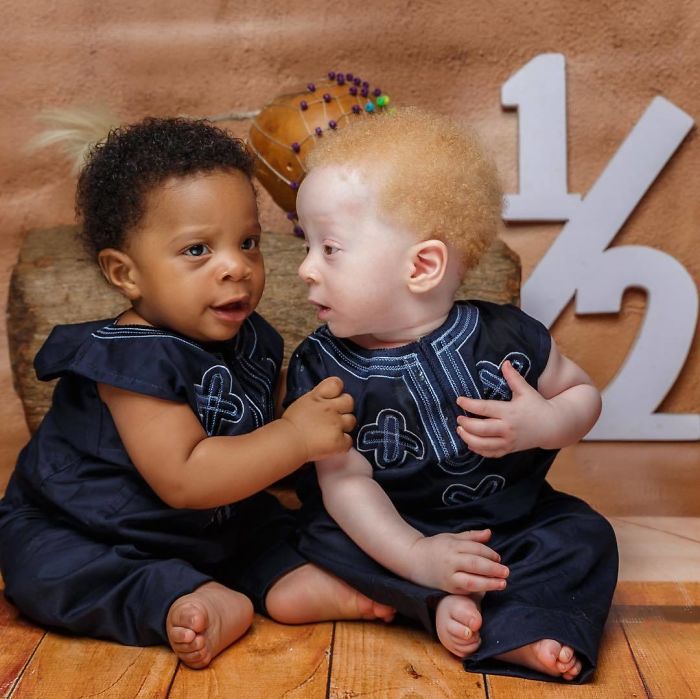 Mom Of Black And White Twins Often Gets Asked Which One Of The Boys Is Hers
