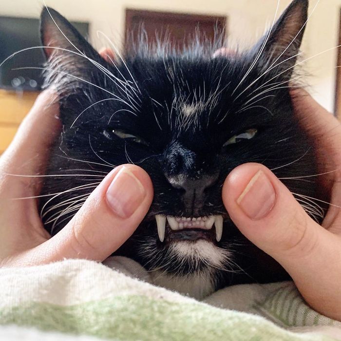 I Have Squint Bottom Teefhs. This Was Taken Shortly Before I Broke My Right Sharp Toofh