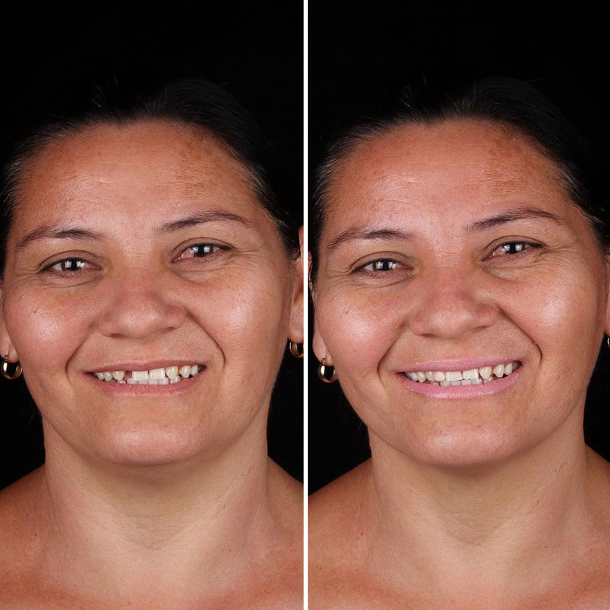 Brazilian Dentist Continues To Travel The World Spreading Smiles To Needy People