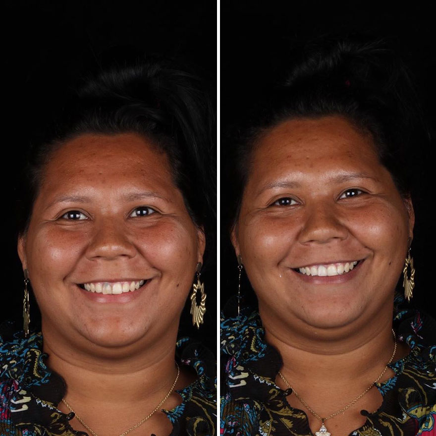 Brazilian Dentist Continues To Travel The World Spreading Smiles To Needy People