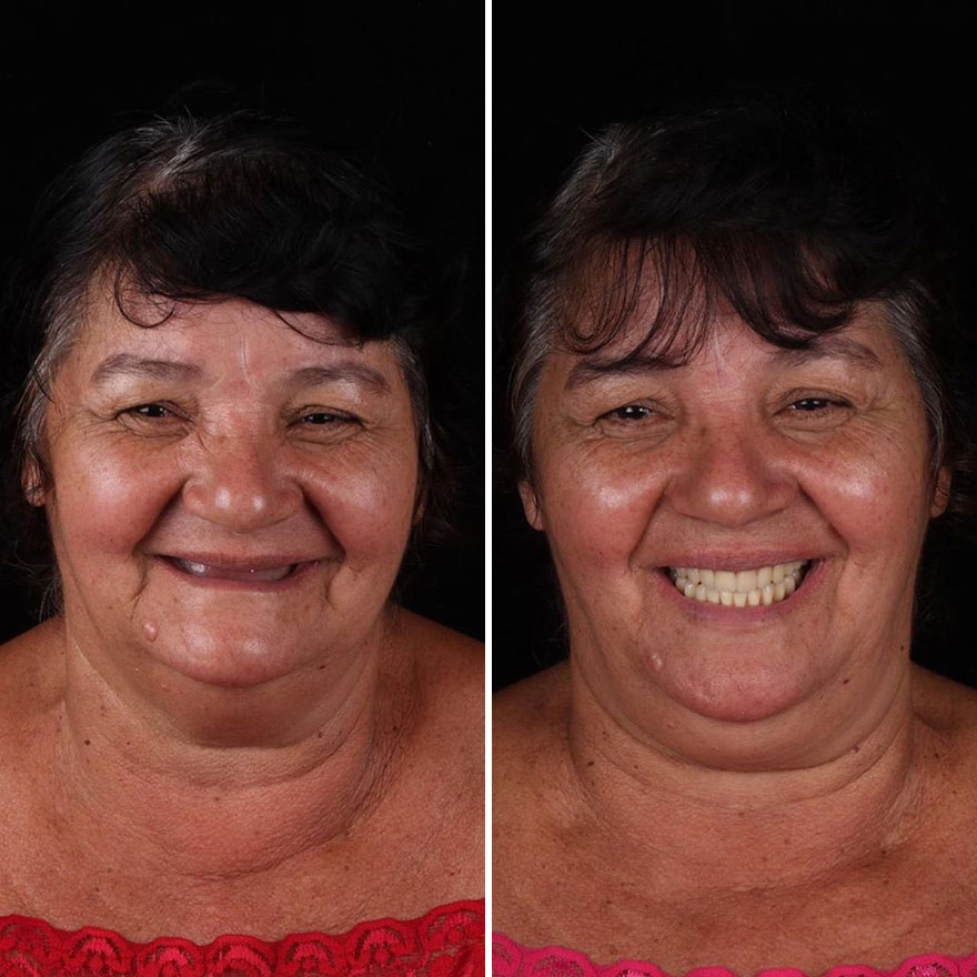 Brazilian Dentist Continues To Travel The World Spreading Smiles To Needy People