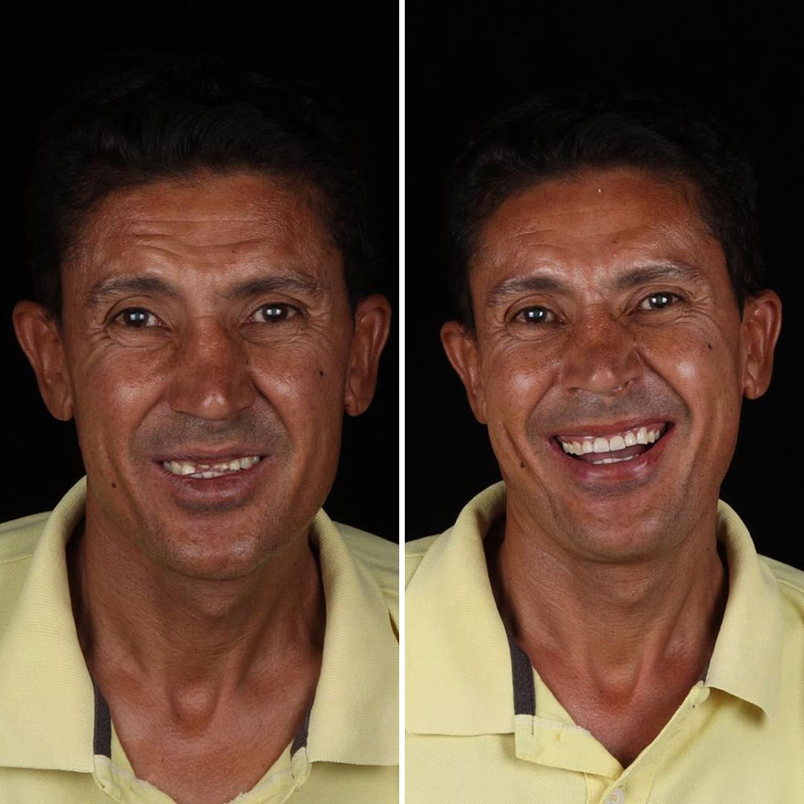 Brazilian Dentist Continues To Travel The World Spreading Smiles To Needy People