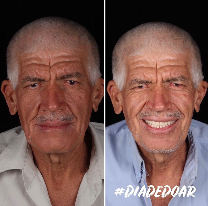 Brazilian Dentist Continues To Travel The World Spreading Smiles To Needy People