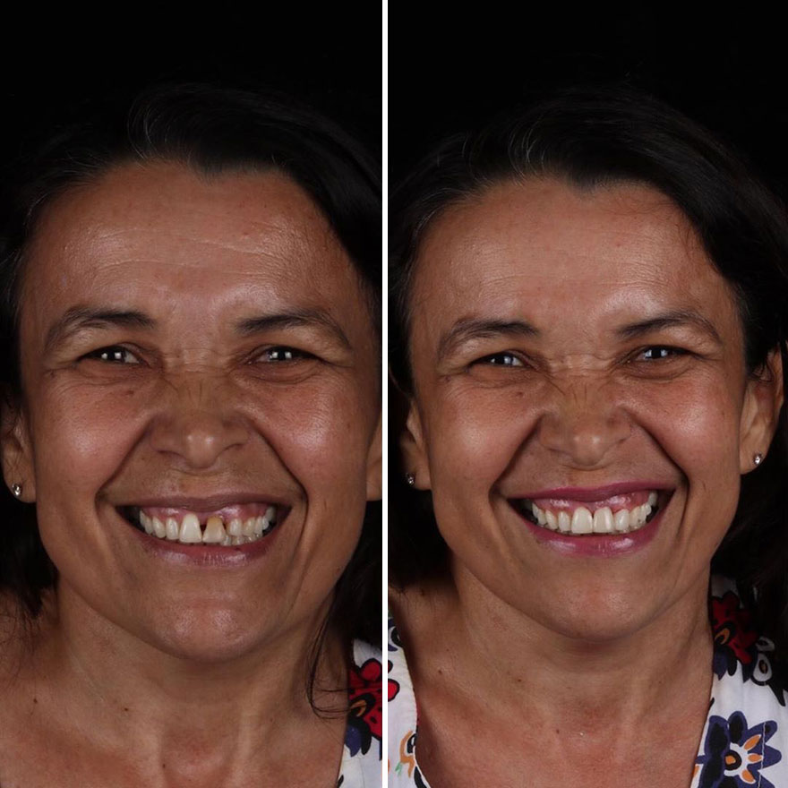 Brazilian Dentist Continues To Travel The World Spreading Smiles To Needy People