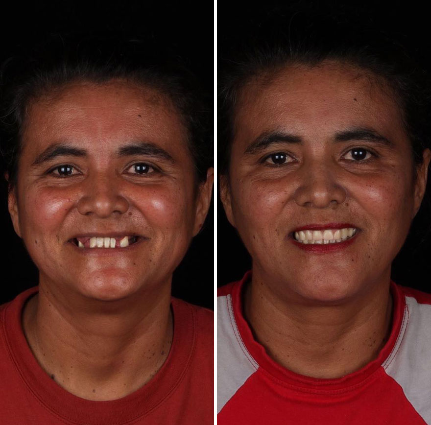 Brazilian Dentist Continues To Travel The World Spreading Smiles To Needy People