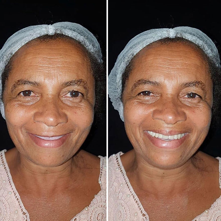 Brazilian Dentist Continues To Travel The World Spreading Smiles To Needy People