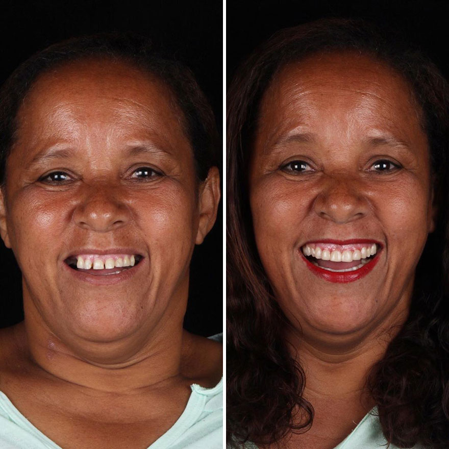 Brazilian Dentist Continues To Travel The World Spreading Smiles To Needy People