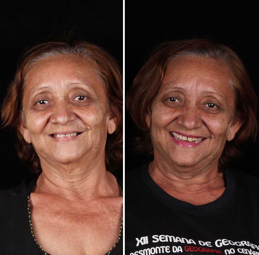 Brazilian Dentist Continues To Travel The World Spreading Smiles To Needy People