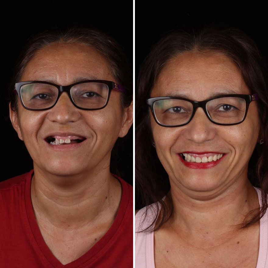 Brazilian Dentist Continues To Travel The World Spreading Smiles To Needy People