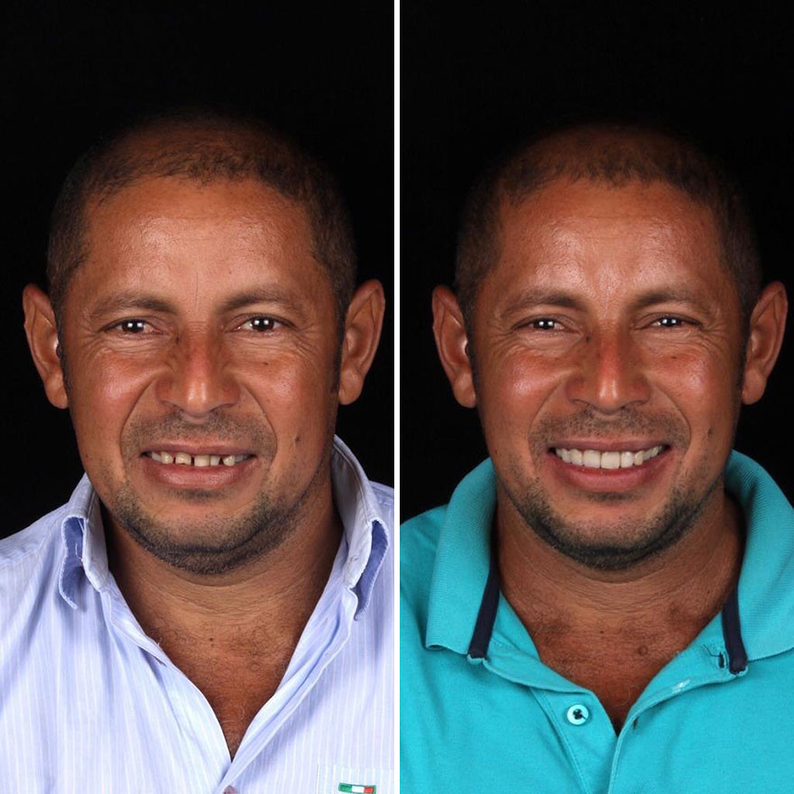 Brazilian Dentist Continues To Travel The World Spreading Smiles To Needy People