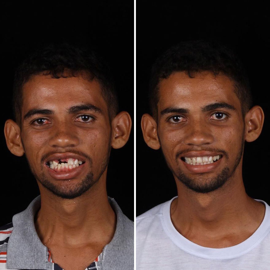 Brazilian Dentist Continues To Travel The World Spreading Smiles To Needy People