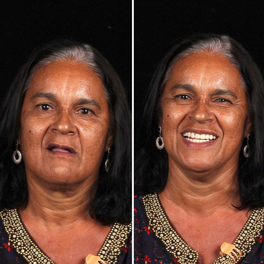 Brazilian Dentist Continues To Travel The World Spreading Smiles To Needy People