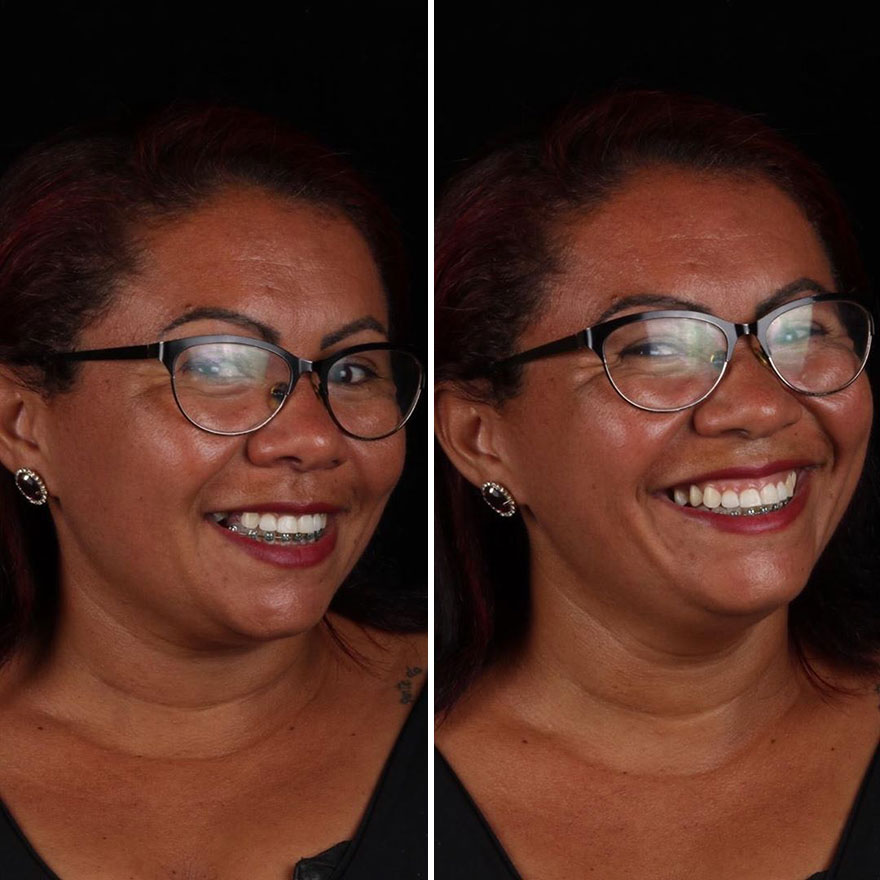 Brazilian Dentist Continues To Travel The World Spreading Smiles To Needy People