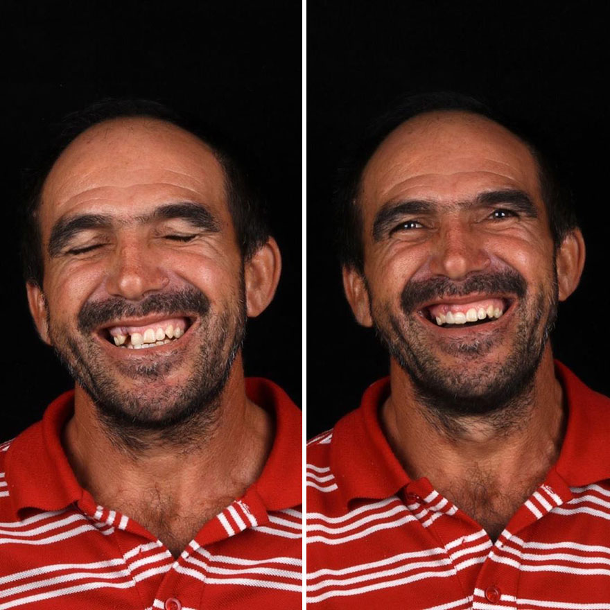 Brazilian Dentist Continues To Travel The World Spreading Smiles To Needy People