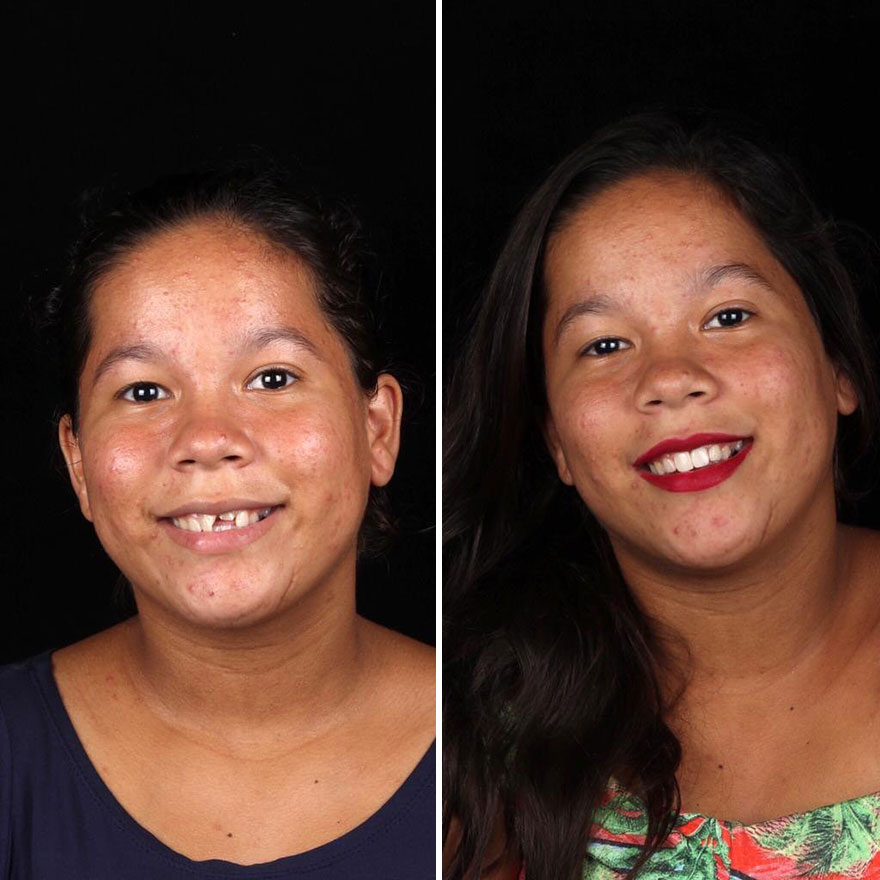 Brazilian Dentist Continues To Travel The World Spreading Smiles To Needy People