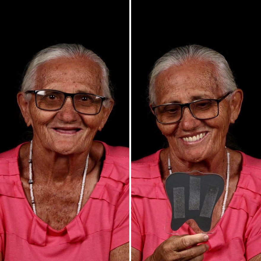 Brazilian Dentist Continues To Travel The World Spreading Smiles To Needy People