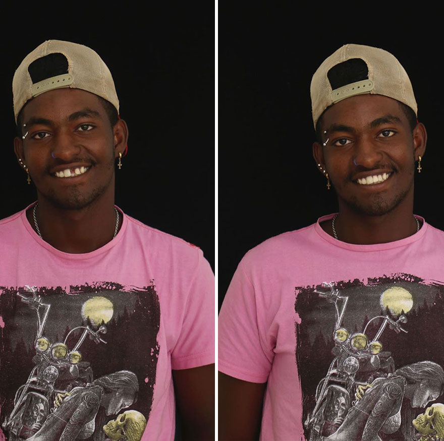 Brazilian Dentist Continues To Travel The World Spreading Smiles To Needy People