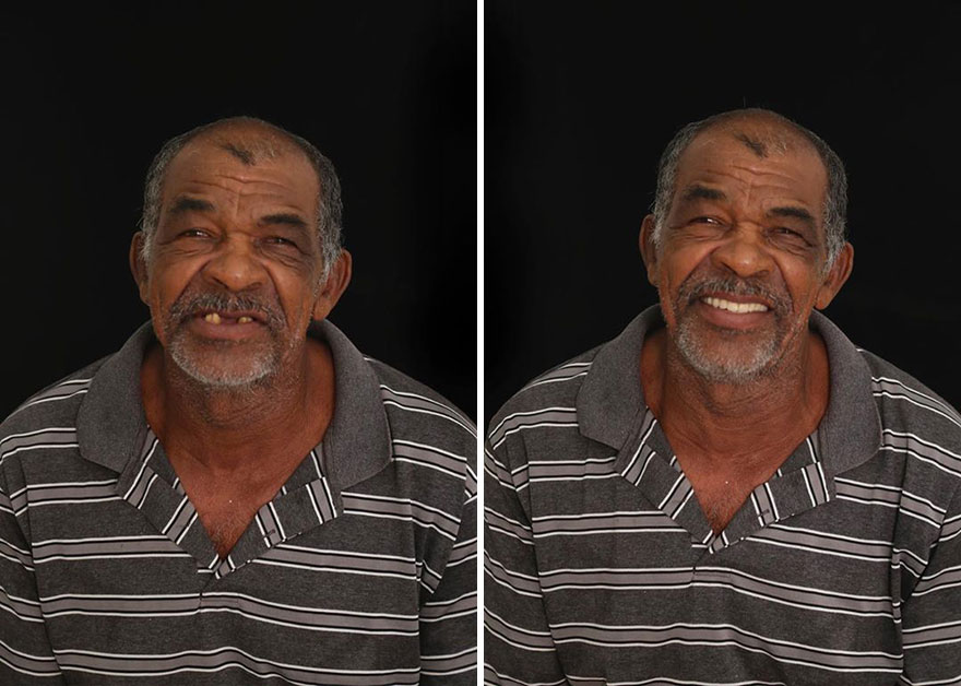 Brazilian Dentist Continues To Travel The World Spreading Smiles To Needy People