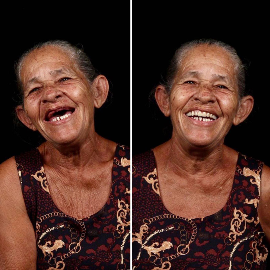 Brazilian Dentist Continues To Travel The World Spreading Smiles To Needy People