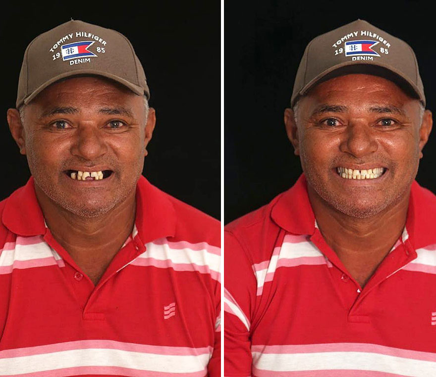 Brazilian Dentist Continues To Travel The World Spreading Smiles To Needy People