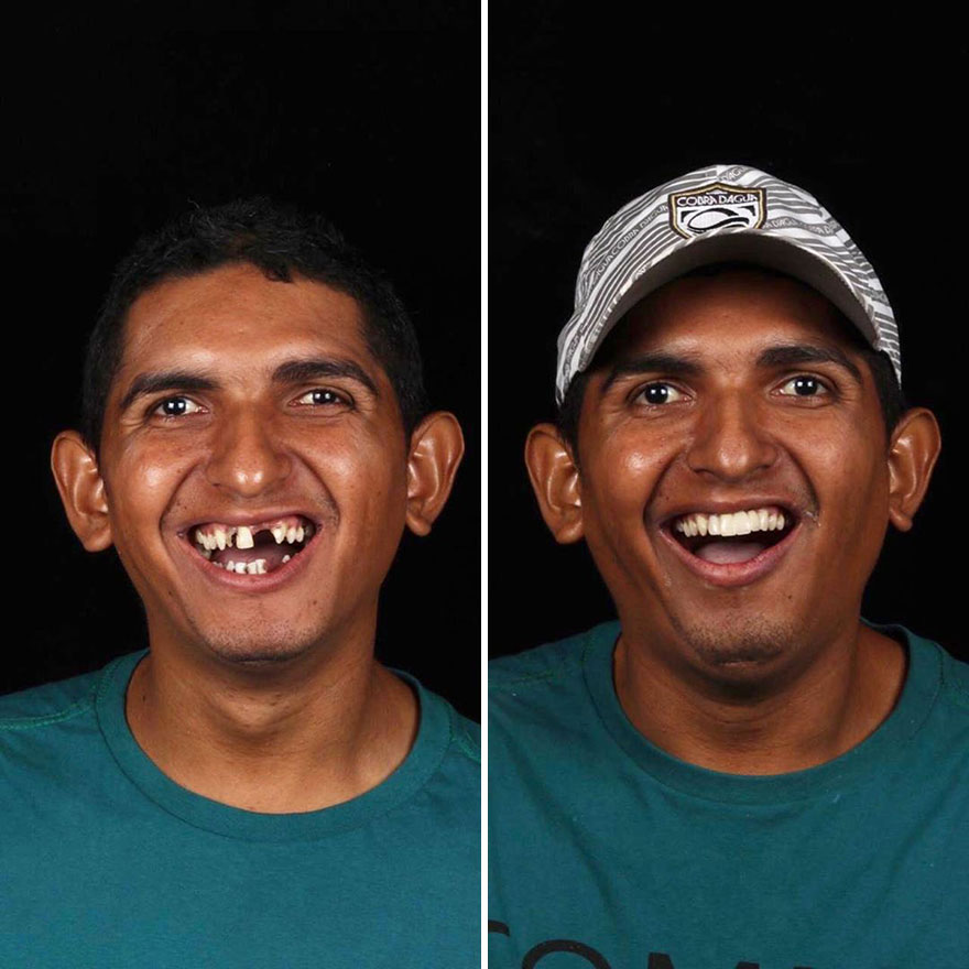 Brazilian Dentist Continues To Travel The World Spreading Smiles To Needy People