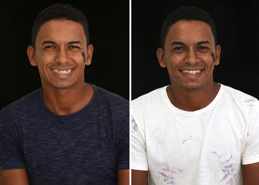 Brazilian Dentist Continues To Travel The World Spreading Smiles To Needy People