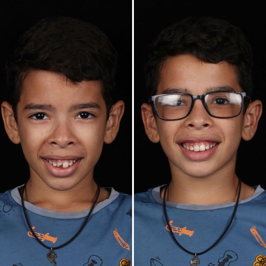 Brazilian Dentist Continues To Travel The World Spreading Smiles To Needy People