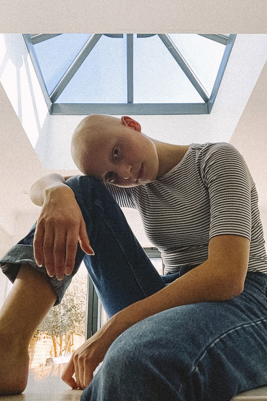 Models With Disabilities And Visbible Differences Take Part In Unique Photoshoots At Home. Project Isolation.