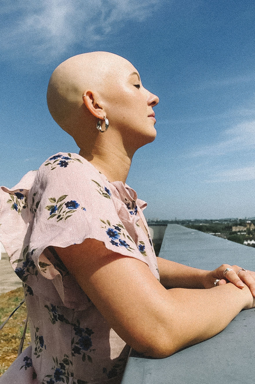 Models With Disabilities And Visbible Differences Take Part In Unique Photoshoots At Home. Project Isolation.