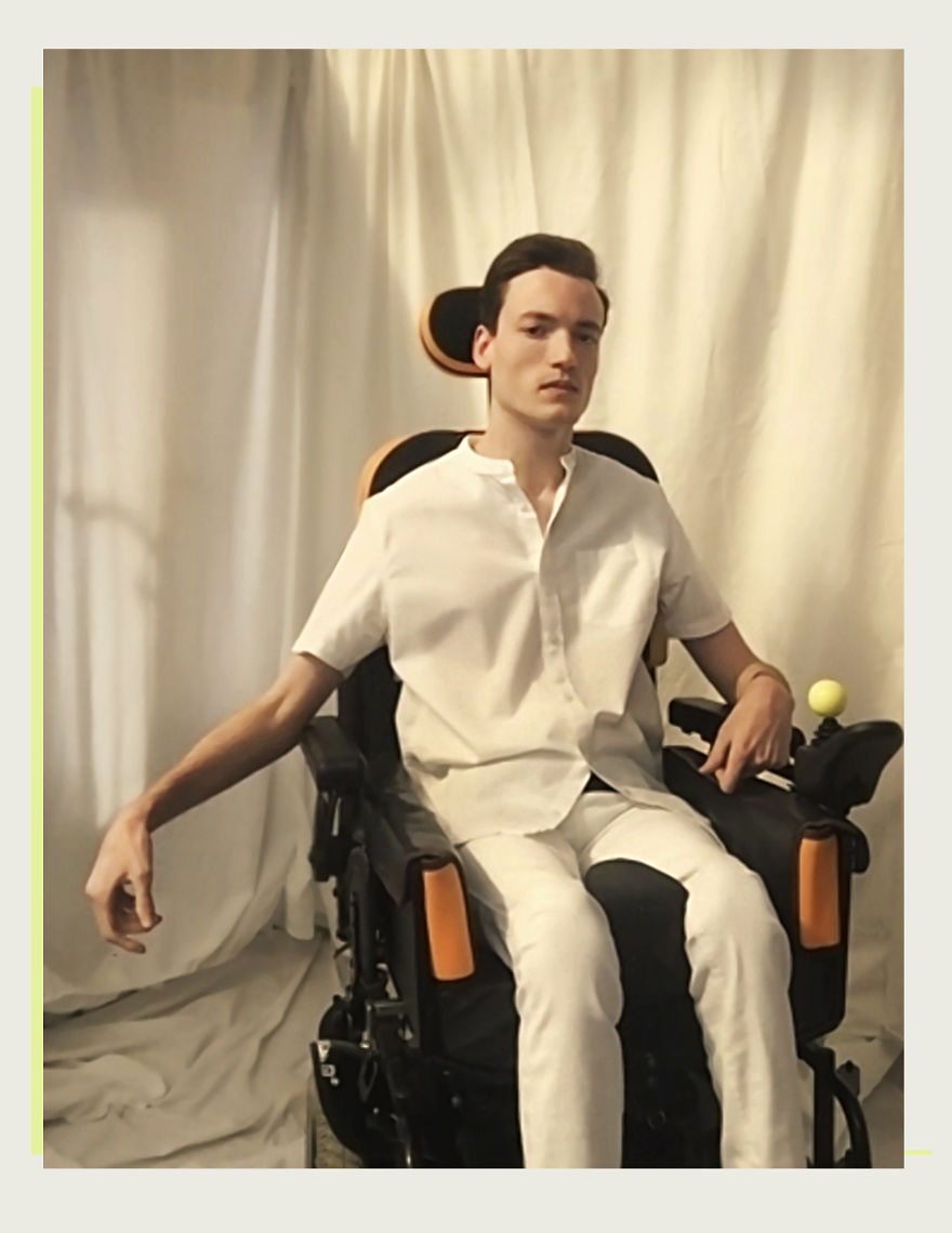 Models With Disabilities And Visbible Differences Take Part In Unique Photoshoots At Home. Project Isolation.