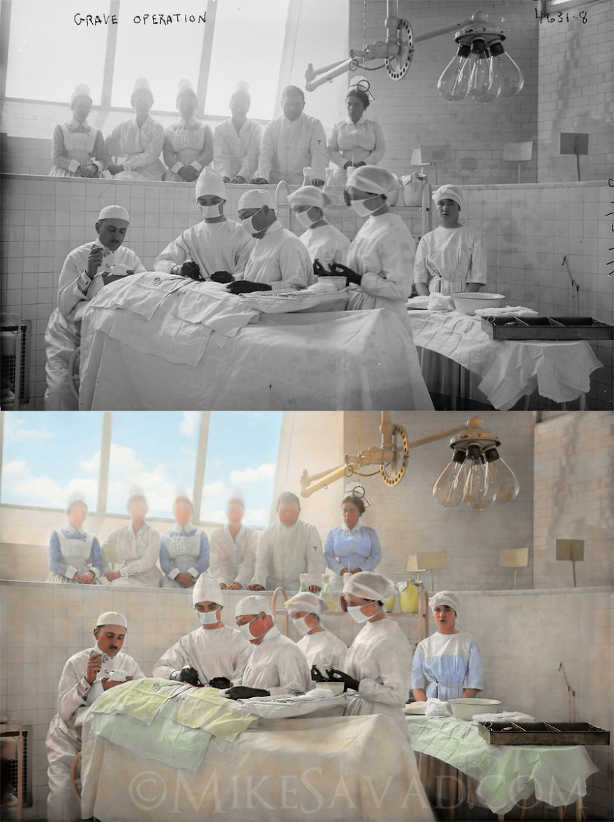 Colorized Medical Pictures (14 Pictures) Colorized Medical Pictures (14 Pictures)