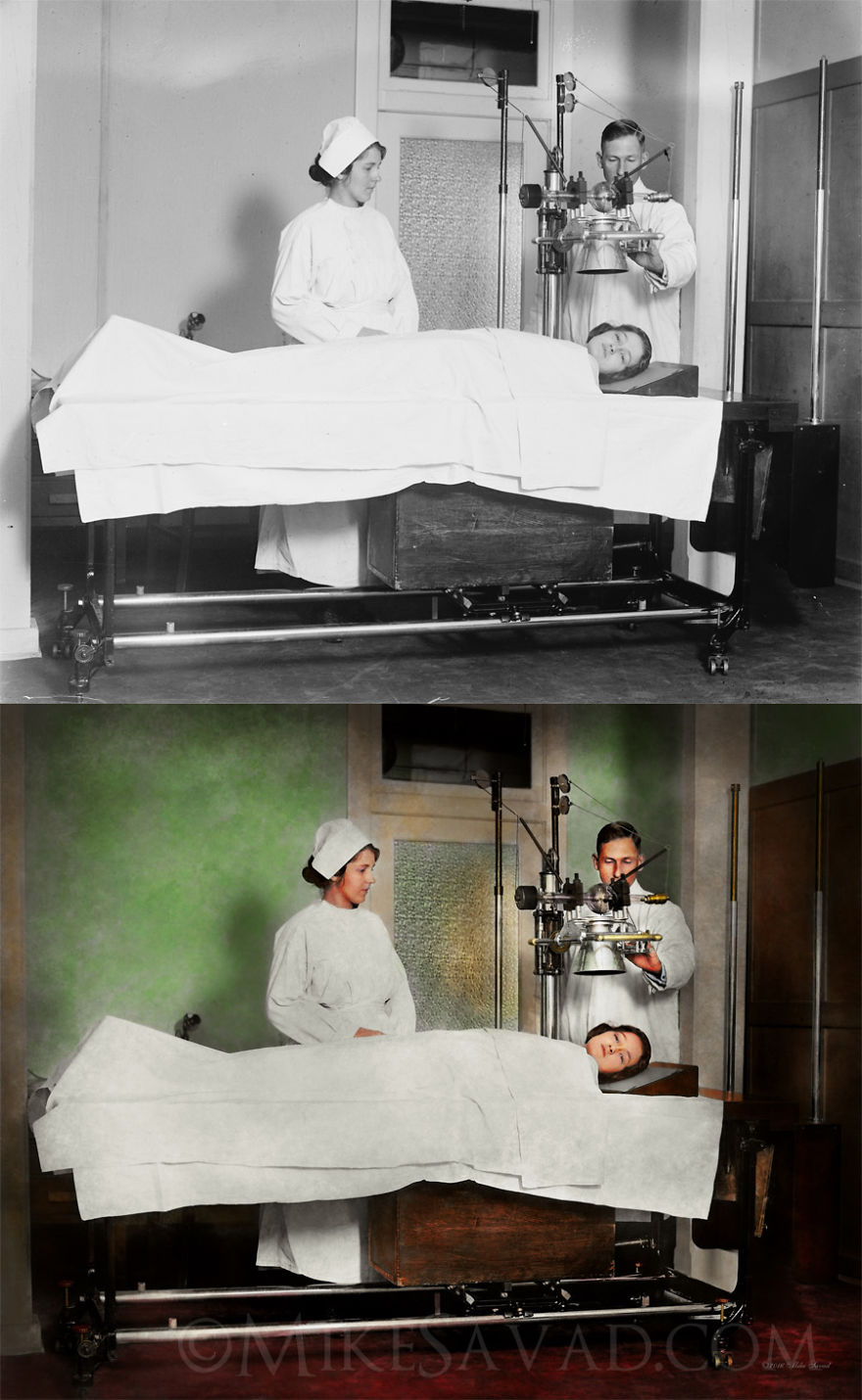 Colorized Medical Pictures (14 Pictures) Colorized Medical Pictures (14 Pictures)