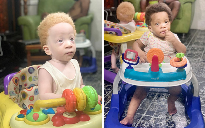 Mom Of Black And White Twins Often Gets Asked Which One Of The Boys Is Hers