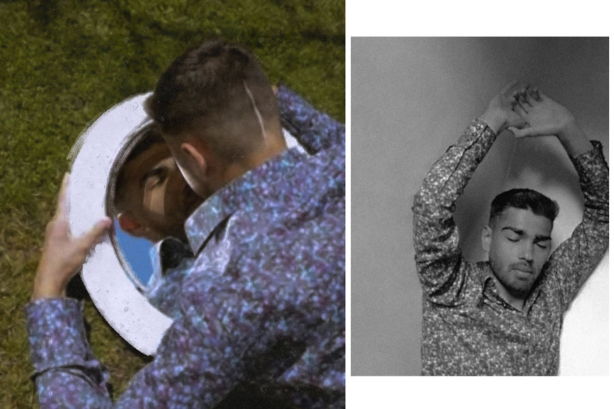 Models With Disabilities And Visbible Differences Take Part In Unique Photoshoots At Home. Project Isolation.