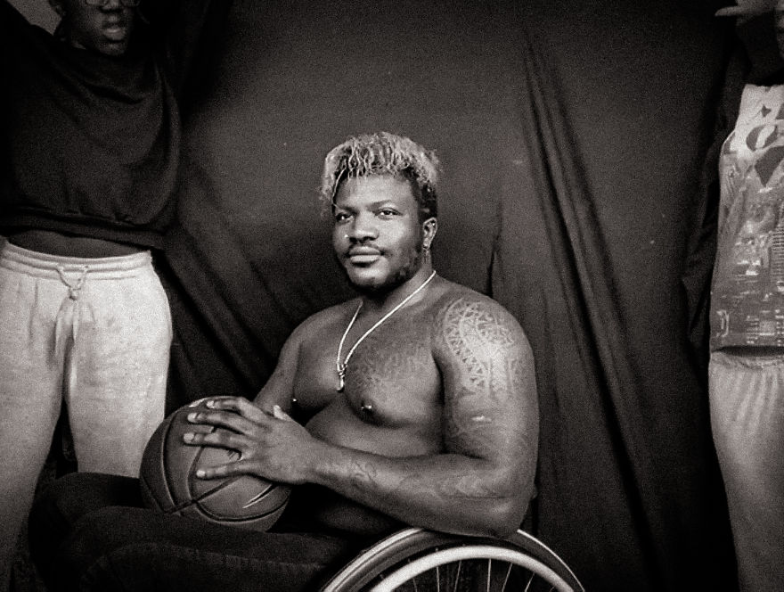 Models With Disabilities And Visbible Differences Take Part In Unique Photoshoots At Home. Project Isolation.