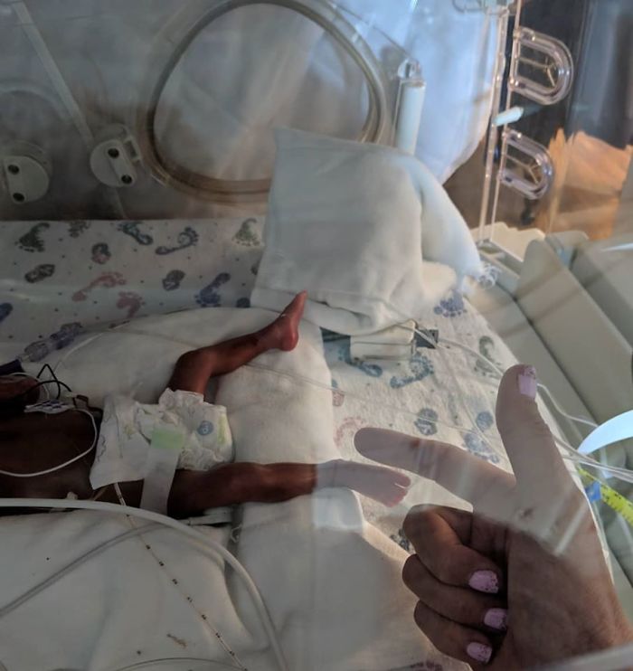 "I Adopted A 'Perfect' Micro-Preemie & Was By His Side As He Died 8 Days Later" "I Adopted A 'Perfect' Micro-Preemie & Was By His Side As He Died 8 Days Later"