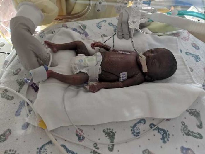 "I Adopted A 'Perfect' Micro-Preemie & Was By His Side As He Died 8 Days Later" "I Adopted A 'Perfect' Micro-Preemie & Was By His Side As He Died 8 Days Later"
