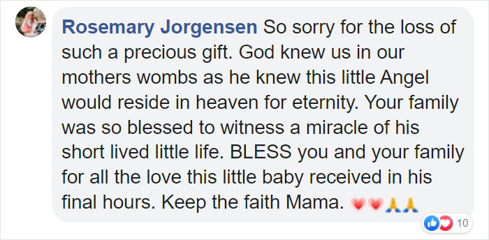 "I Adopted A 'Perfect' Micro-Preemie & Was By His Side As He Died 8 Days Later" "I Adopted A 'Perfect' Micro-Preemie & Was By His Side As He Died 8 Days Later"