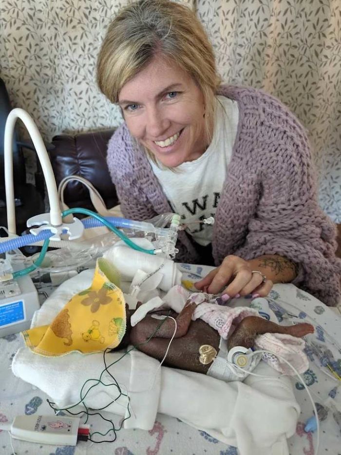 "I Adopted A 'Perfect' Micro-Preemie & Was By His Side As He Died 8 Days Later"