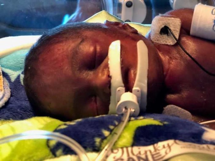 "I Adopted A 'Perfect' Micro-Preemie & Was By His Side As He Died 8 Days Later" "I Adopted A 'Perfect' Micro-Preemie & Was By His Side As He Died 8 Days Later"