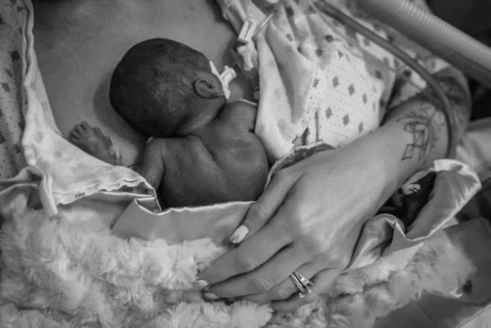 "I Adopted A 'Perfect' Micro-Preemie & Was By His Side As He Died 8 Days Later" "I Adopted A 'Perfect' Micro-Preemie & Was By His Side As He Died 8 Days Later"